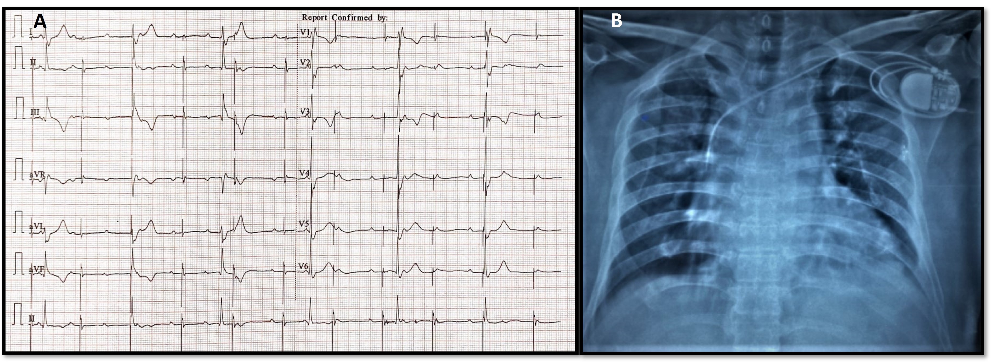 Size it and Fix it': Pulsatile Abdomen and Presyncope Post